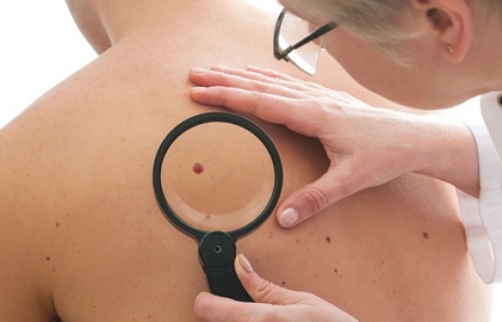 Beni olanlar dikkat! Kanser habercisi olabilir...