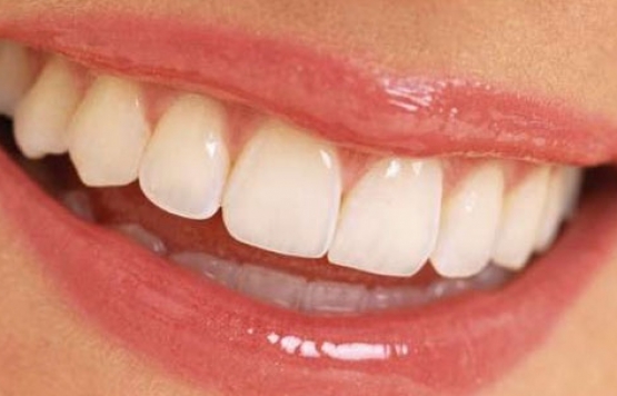 Soğuk havalarda dişleriniz sızlıyorsa dikkat!